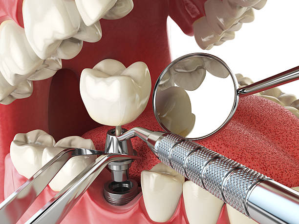 Best Urgent Tooth Repair  in Aiken, SC
